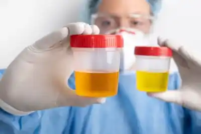 Narcotest sorpresivos para diputados: el protocolo que aprobó Neuquén y cómo funcionará