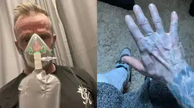 Despertó con la piel de otro color y el pánico lo llevó de urgencia al hospital: el insólito motivo