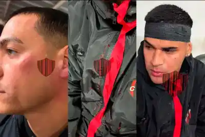 Golpes y sangre en el Grella: la violenta bienvenida que recibieron dos jugadores de Patronato