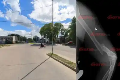 Choque en Av. Lugones: un auto negro huyó y dejó a un cadete con el brazo quebrado