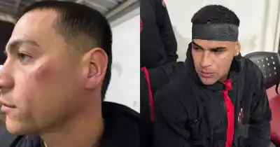 El ataque que nadie esperaba: la barra de Patronato agredió a los jugadores tras la caída ante Colón