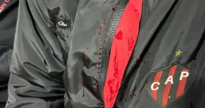 Golpeado con la culata de un arma: el dramático relato del jugador de Patronato tras el ataque de la barra