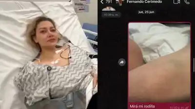 Exnovia de Fernando Cerimedo difundió chats con fotos de sus lesiones y lo acusó de violencia de género
