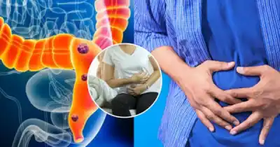 Alerta en la Patagonia: el norovirus ya circula cerca de Santa Cruz y preocupa a las autoridades