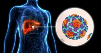 Salta en alerta: la hepatitis A avanza y ya son 13 los casos confirmados en 2026