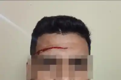 Agredió con un destornillador a un policía en Gualeguaychú y el arma quedó secuestrada