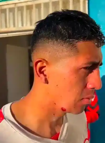 Un jugador con perdigones en la cara: la dura denuncia de Huracán tras los incidentes con la Policía