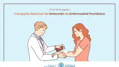 Atención gratuita para detectar psoriasis: cómo acceder a los especialistas en Tucumán