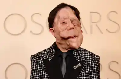 De la exclusión a la alfombra roja: la historia detrás del rostro que desafía a Hollywood
