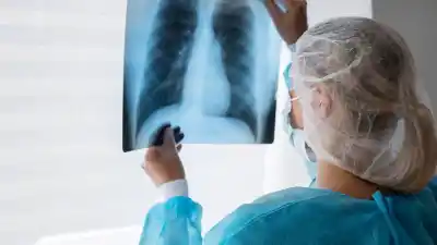 La Súper Gripe arrasó en 2026: el récord que preocupa y la señal que alienta