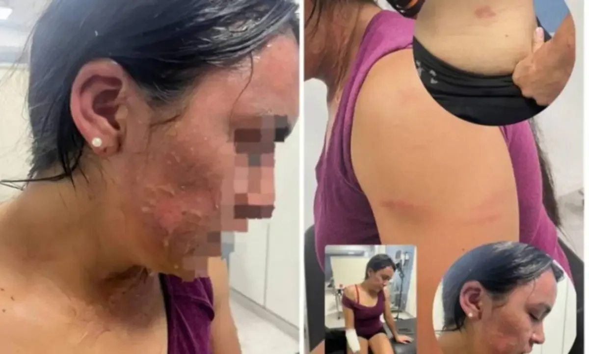 1200x721_la-vctima-asi-quedo-mujer-agredida-imagen-se-viralizo-redes-sociales-1132392-180118.webp