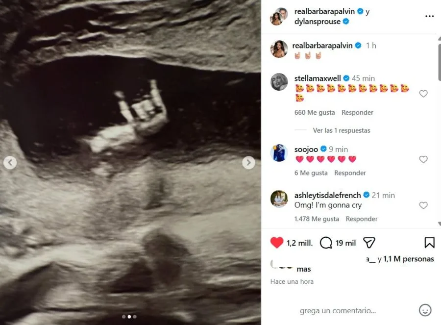 barbara-palvin-y-dylan-sprouse-esperan-su-primer-hijo-juntos-la-ecografia-2240137.jpg