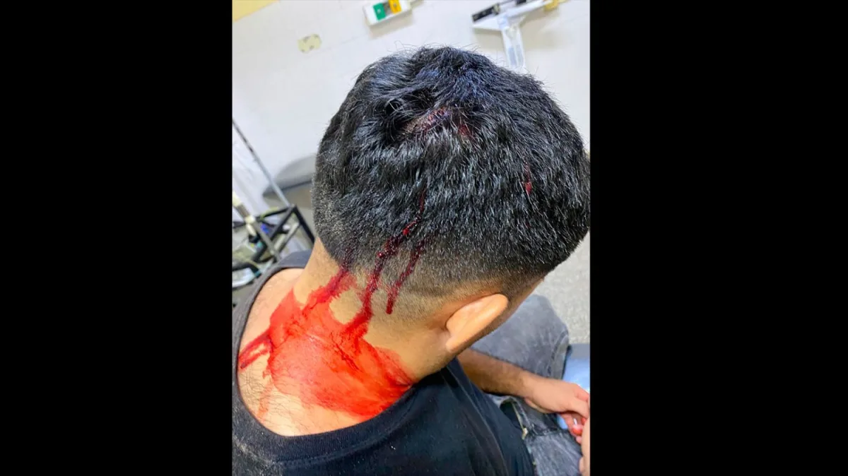 Así quedó el joven golpeado