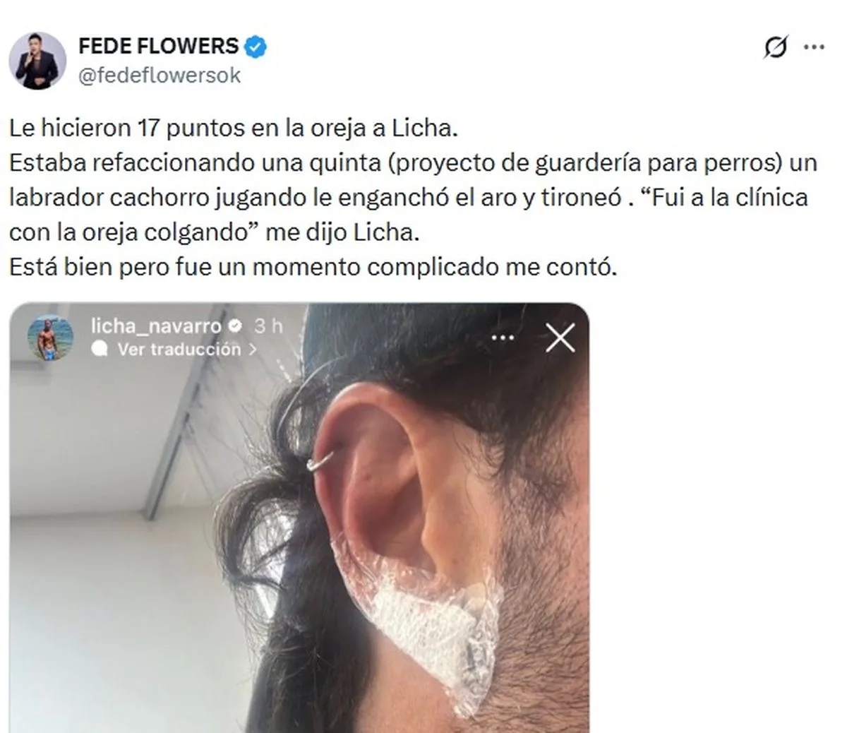 Lisandro Navarro muestra su lesión en la oreja