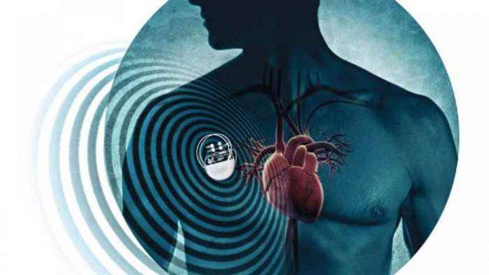 Synchromax el GPS para el corazón, un monterizo entre los evolucionarios de la ciencia
