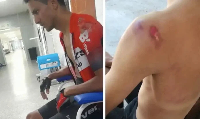 ATROPELLADO MIENTRAS ENTRENABA